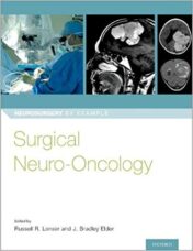 Surgical Neuro-Oncology (Neurosurgery by Example) (Original PDF) 2018
