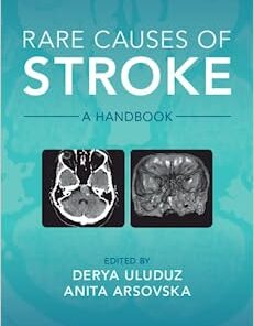 Rare Causes of Stroke: A Handbook (Original PDF from Publisher)