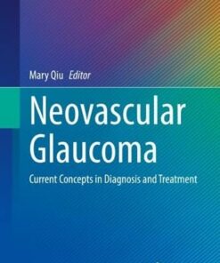 Neovascular Glaucoma: Current Concepts in Diagnosis and Treatment (Essentials in Ophthalmology) (Original PDF from Publisher)