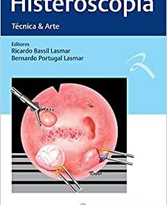 Histeroscopia: Técnica & Arte (Original PDF from Publisher)