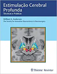 Estimulação Cerebral Profunda: Técnicas e Práticas (Original PDF from Publisher)