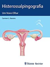 Histerossalpingografia: Um Novo Olhar (Portuguese Edition) (ePub+azw3+Converted PDF)