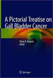 A Pictorial Treatise on Gall Bladder Cancer (Original PDF)