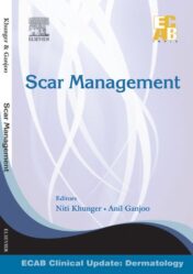 Scar Management - ECAB 2013 Original PDF