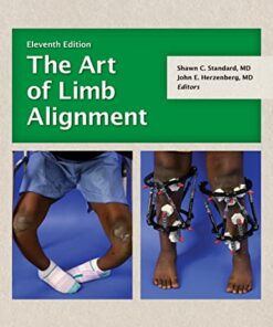 The Art Of Limb Alignment, 11th Edition (Original PDF From Publisher)