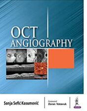 OCT Angiography (Original PDF)