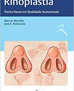 Rinoplastia: Ponta Nasal em Realidade Aumentada (Original PDF from Publisher)