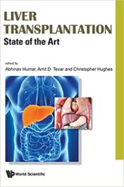 Liver Transplantation: State of the Art (Original PDF)