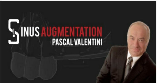 Sinus Augmentation International