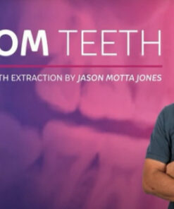 Wisdom Teeth Extraction