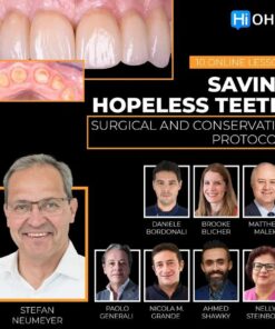 OHI-S Saving Hopeless Teeth, Surgical and Conservative Protocols