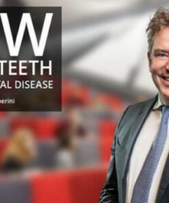 How To Save Teeth With Periodontal Disease