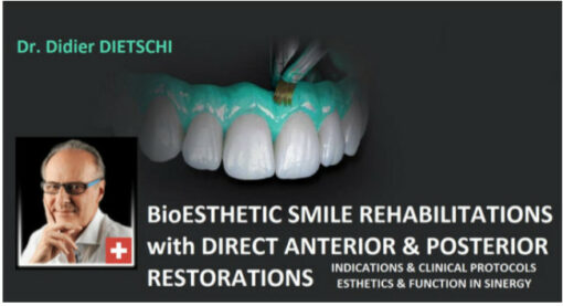 BioEsthetic Smile Rehabilitations with Direct Anterior & Posterior Restorations