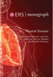 ERS Monograph 87: Pleural Disease ORIGINAL PDF
