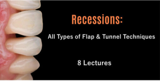 Recessions: All Types of Flap & Tunnel Techniques