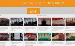 FULL SERIES CLINICAL VIDEOS DENTISTRY - GIDE
