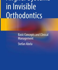 Aligner Systems in Invisible Orthodontics: Basic Concepts and Clinical Management PDF 