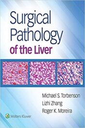 Surgical Pathology of the Liver (EPUB+PDF)