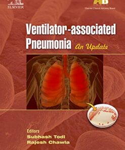 ECAB Clinical Update – Ventilator-associated Pneumonia – E-Book (Original PDF from Publisher)