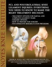 PCL and Posterolateral Knee Ligament Injuries: Everything You Need to Know to Make the Right Treatment Decision: Treatment options for partial and complete ligament tears - Surgery options-How to pre pdf 2013
