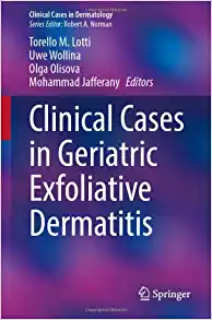 Clinical Cases in Geriatric Exfoliative Dermatitis (Clinical Cases in Dermatology) (Original PDF from Publisher)