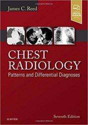 Chest Radiology: Patterns and Differential Diagnoses, 7th Edition (PDF)