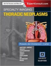 Specialty Imaging: Thoracic Neoplasms (Original PDF)