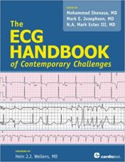 The ECG Handbook of Contemporary Challenges (PDF) 2015
