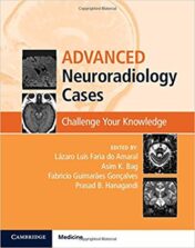 Advanced Neuroradiology Cases: Challenge Your Knowledge, 1e (ORIGINAL PDF)