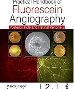 Practical Handbook of Fluorescein Angiography: Posterior Pole and Retinal Periphery, 2nd Edition (Original PDF from Publisher)