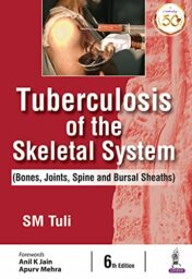 Tuberculosis Of The Skeletal System (Bones, Joints, Spine And Bursal Sheaths) Original PDF  
