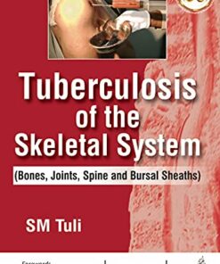 Tuberculosis Of The Skeletal System (Bones, Joints, Spine And Bursal Sheaths) (Original PDF from Publisher)