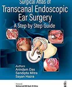 Surgical Atlas of Transcanal Endoscopic Ear Surgery: A Step by Step Guide (Original PDF from Publisher)