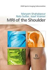 MRI of the Shoulder 2018 Original PDF