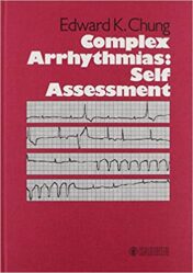 Complex Arrhythmias: Self Assessment (PDF) 1985