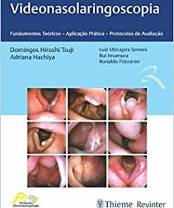 Videonasolaringoscopia: Fundamentos Teóricos – Aplicação Prática – Protocolos de Avaliação, 1ª edição (Original PDF from Publisher)