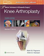 Master Techniques in Orthopedic Surgery: Knee Arthroplasty (Master Techniques in Orthopaedic Surgery) Fourth Ed 2018 ORIGINAL PDF