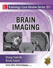 Radiology Case Review Series: Brain Imaging (EPUB and CONVERTED PDF)