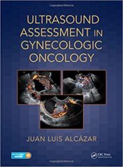 Ultrasound Assessment in Gynecologic Oncology (PDF)