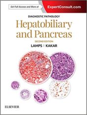 Diagnostic Pathology: Hepatobiliary and Pancreas E-Book, 2nd Edition (PDF)