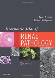 Diagnostic Atlas of Renal Pathology, 3rd Edition (Original PDF)