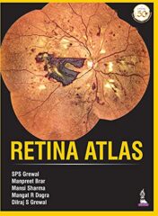 Retina Atlas Original PDF 