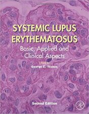 Systemic Lupus Erythematosus : Basic, Applied and Clinical Aspects (PDF) 2020