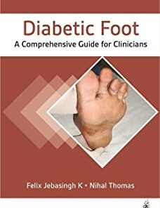 Diabetic Foot : A Comprehensive Guide for Clinicians (Original PDF from Publisher)