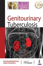 Genitourinary Tuberculosis (Original PDF)