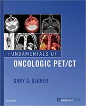 Fundamentals of Oncologic PET/CT (Fundamentals of Radiology) (PDF)