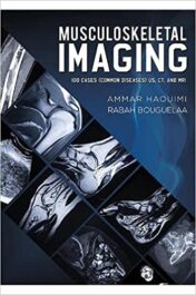 Musculoskeletal Imaging: 100 Cases (Common Diseases) US, CT and MRI EPUB+Converted PDF 2021