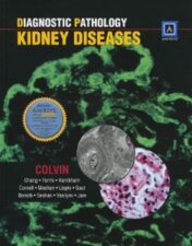 Diagnostic Pathology: Kidney Diseases (High Quality CHM)