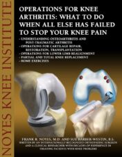 Operations for Knee Arthritis: What To Do When All Else Has Failed To Stop Your Knee Pain