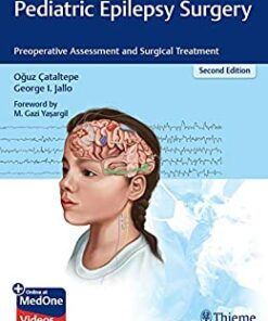 Pediatric Epilepsy Surgery: Preoperative Assessment and Surgical Treatment, 2nd Edition (EPUB)